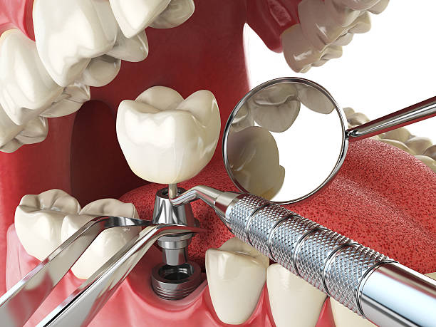 Best Emergency Treatment for Toothache in Brighton, TN